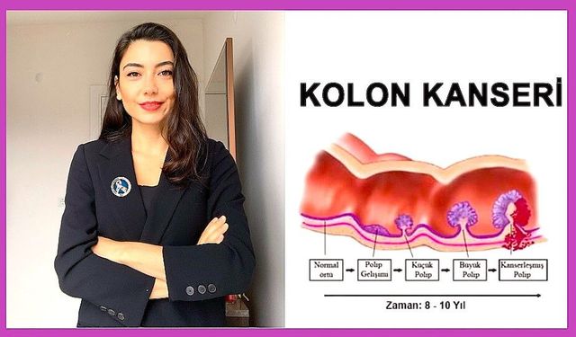 50 Yaştan Sonra Kolon Kanseri Riski Artıyor