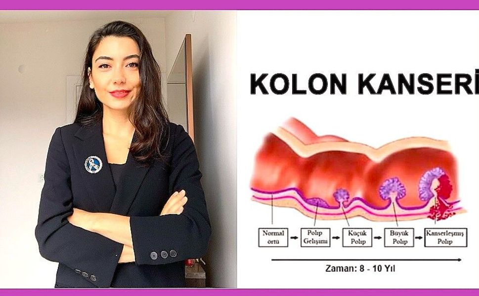 50 Yaştan Sonra Kolon Kanseri Riski Artıyor